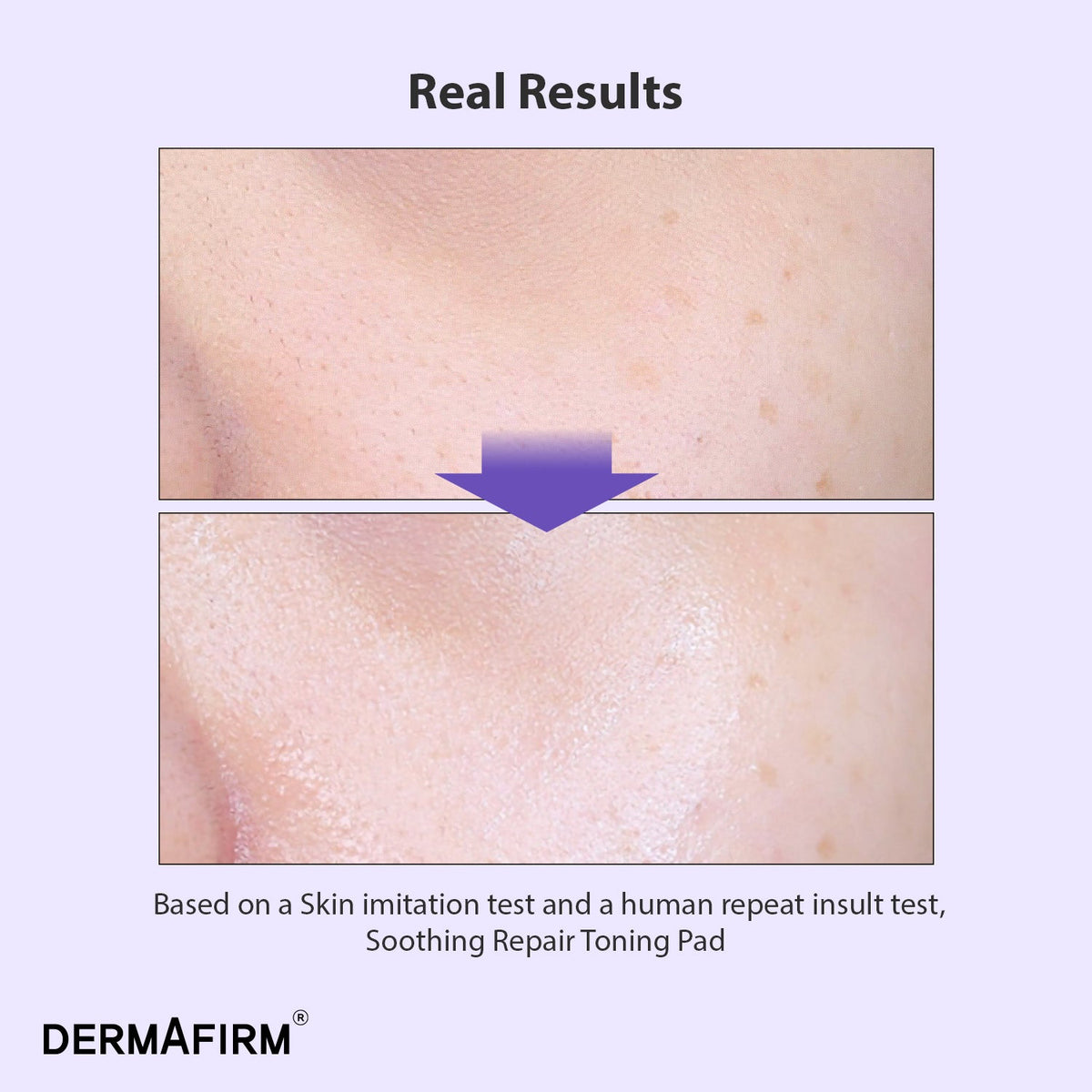Dermafirm 舒緩修護調理棉片
